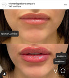 Lipsmart Hydrating Lip Treatment