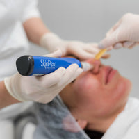 SkinPen Microneedling with PRP